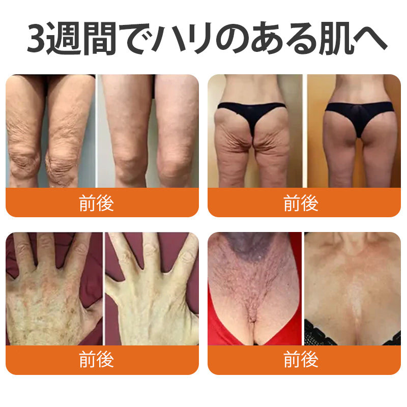 🧑‍⚕️Cusire ®ビーベノム リペア再生クリーム🔥天然由来のエイジングケアで肌を引き締め、ハリを与え、乾燥による小ジワを目立たなくします – 50mL