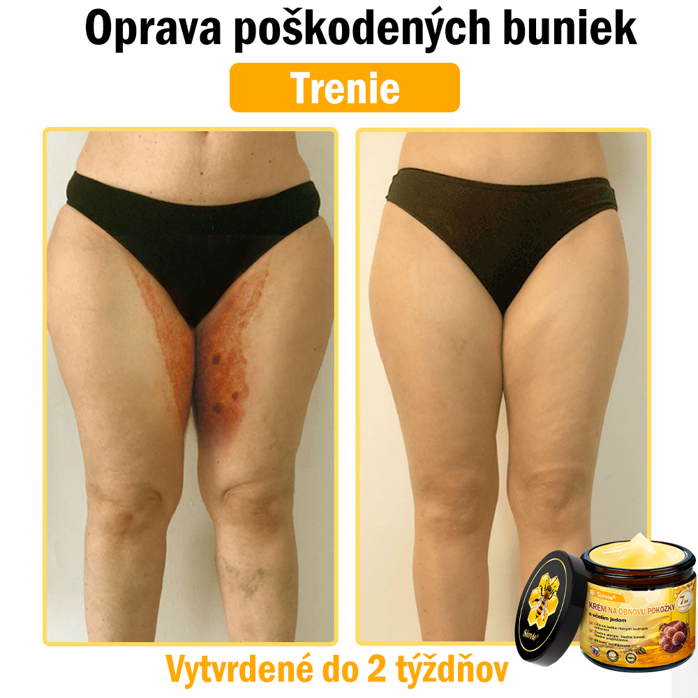 ✨ Sinvie® včelím jedom obnovu pokožky Krém (👨‍⚕‍Výroba v súlade s normami GMP)👍✅