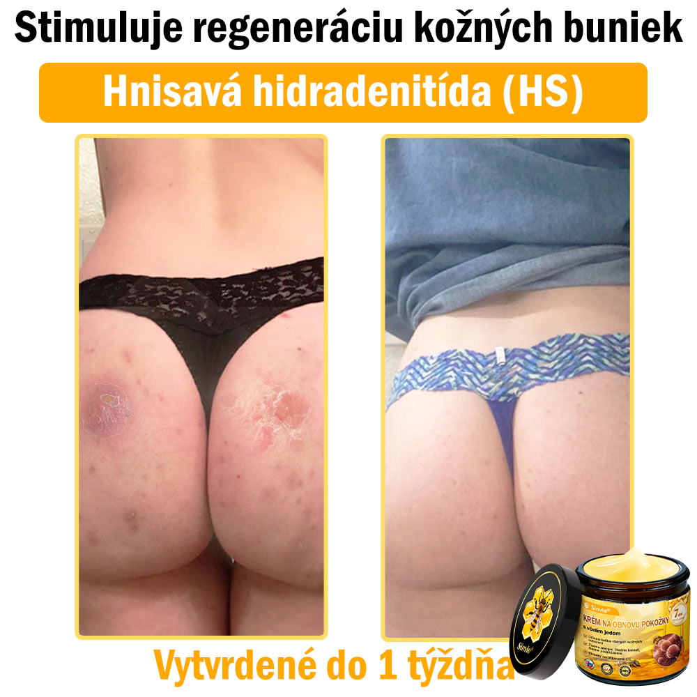✨ Sinvie® včelím jedom obnovu pokožky Krém (👨‍⚕‍Výroba v súlade s normami GMP)👍✅