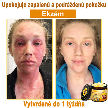 ✨ Sinvie® včelím jedom obnovu pokožky Krém (👨‍⚕‍Výroba v súlade s normami GMP)👍✅