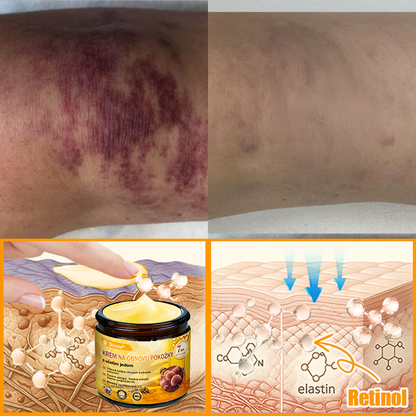 ✨ Sinvie® včelím jedom obnovu pokožky Krém (👨‍⚕‍Výroba v súlade s normami GMP)👍✅