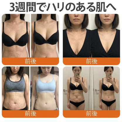 🧑‍⚕️Cusire ®ビーベノム リペア再生クリーム🔥天然由来のエイジングケアで肌を引き締め、ハリを与え、乾燥による小ジワを目立たなくします – 50mL