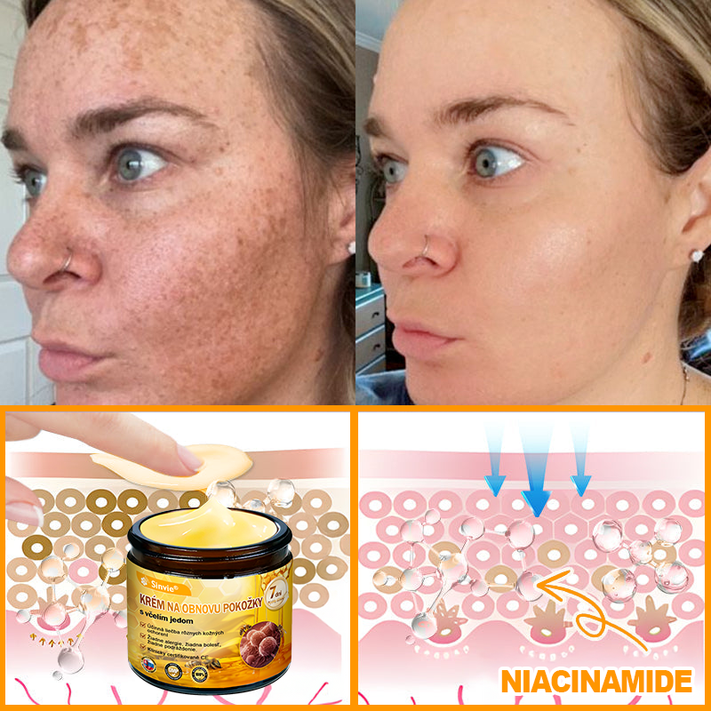 ✨ Sinvie® včelím jedom obnovu pokožky Krém (👨‍⚕‍Výroba v súlade s normami GMP)👍✅