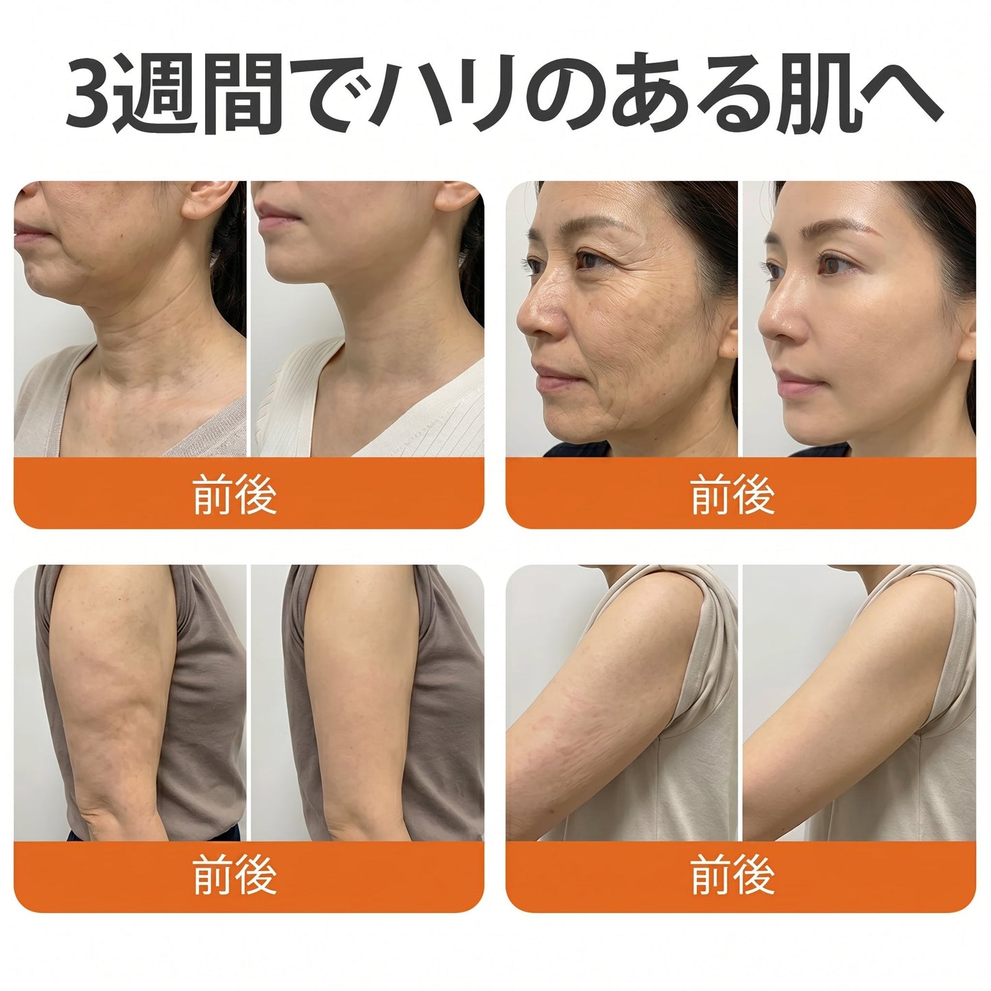 🧑‍⚕️Cusire ®ビーベノム リペア再生クリーム🔥天然由来のエイジングケアで肌を引き締め、ハリを与え、乾燥による小ジワを目立たなくします – 50mL