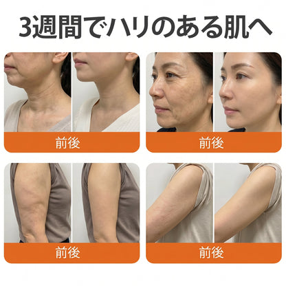 🧑‍⚕️Cusire ®ビーベノム リペア再生クリーム🔥天然由来のエイジングケアで肌を引き締め、ハリを与え、乾燥による小ジワを目立たなくします – 50mL